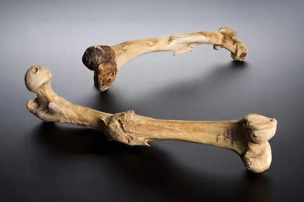 femur roto sanado
